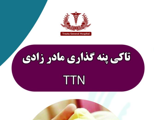 تاکی پنه گذاری