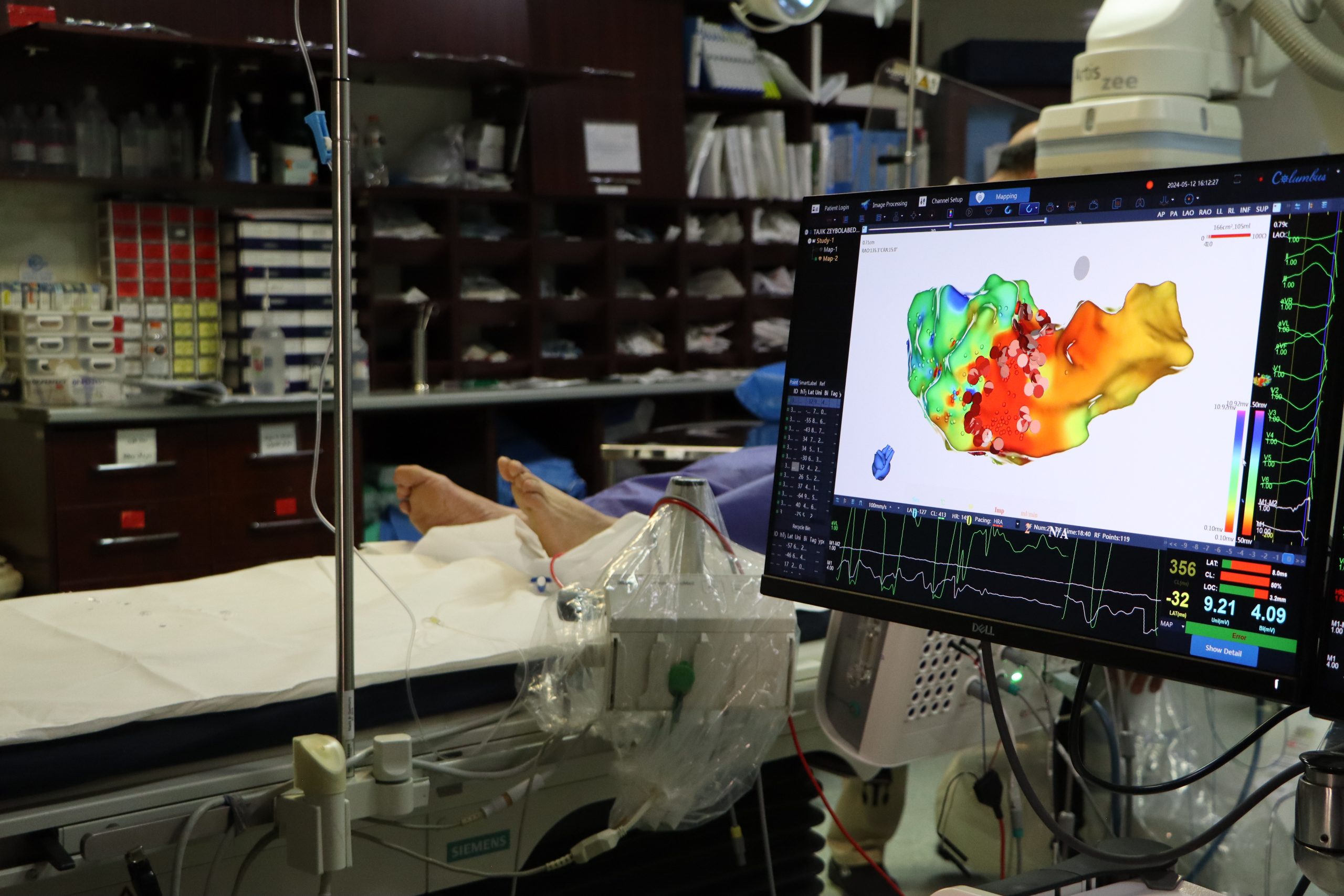 دستگاه 3D ablation