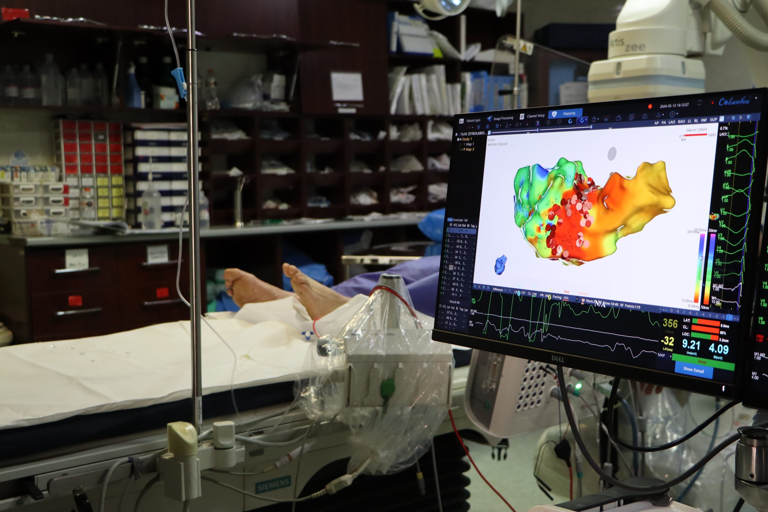 دستگاه 3D ablation