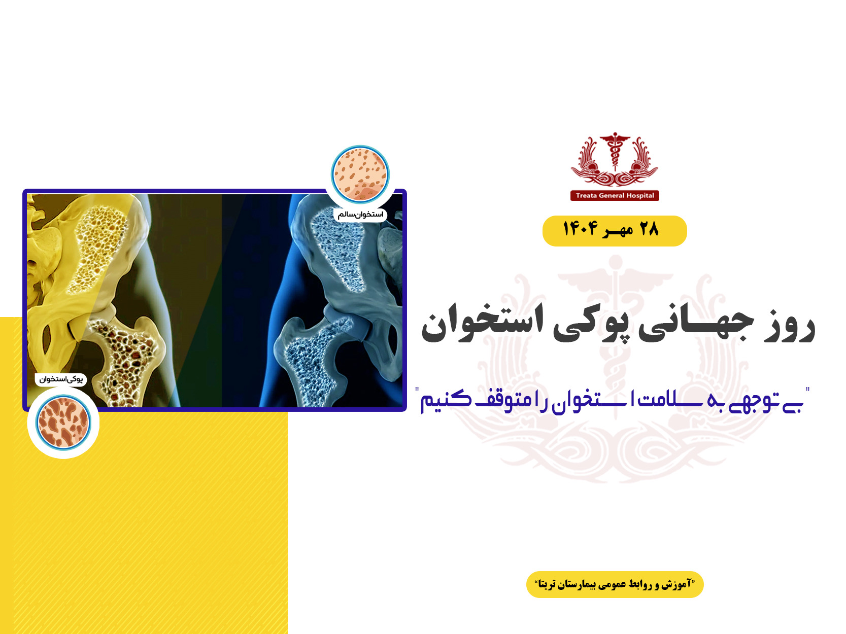 روز جهانی پوکی استخوان